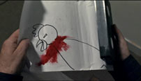 Fig.13: Mere blod.